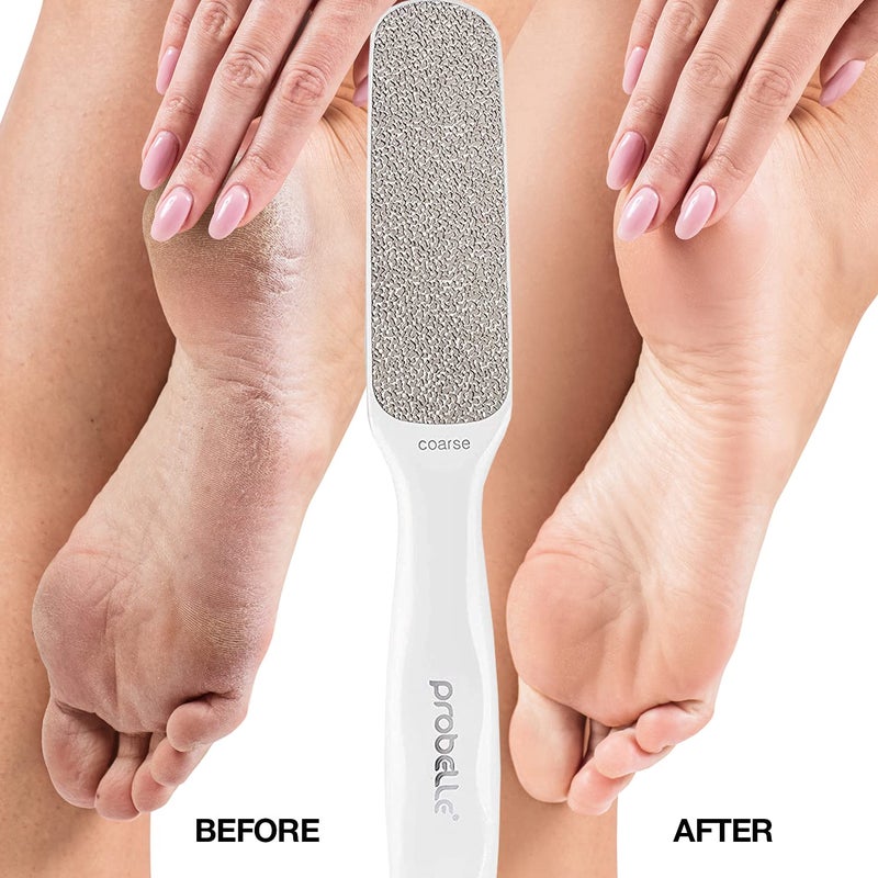 Probelle Double Sided Multidirectional Nickel Foot File Callus Remover - Immediately reduces calluses and corns to powder for instant results  safe tool (White) - Image 4